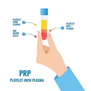 Platelet Rich Plasma Image separated in test tube
